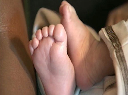 طفل 9 اشهر يخضع لاندر العمليات لازالة اصابعه الزائدة!!        صورة رقم 5