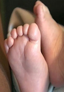 طفل 9 اشهر يخضع لاندر العمليات لازالة اصابعه الزائدة!!        صورة رقم 1