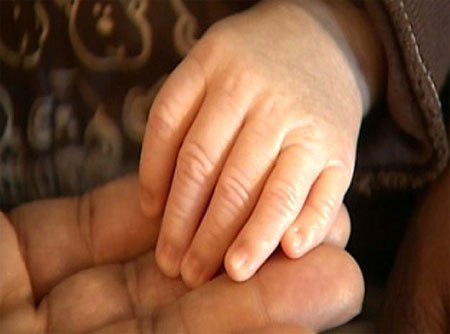 طفل 9 اشهر يخضع لاندر العمليات لازالة اصابعه الزائدة!!        صورة رقم 4