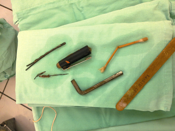 مواطن من حيفا يبتلع صندوق عدة! صورة رقم 2 مواطن من حيفا يبتلع صندوق عدة! صورة رقم 2