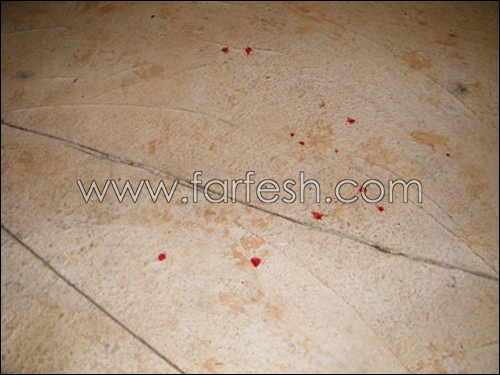 الرصاصة الطائشة واصابة جديدة في عرابة صورة رقم 2 الرصاصة الطائشة واصابة جديدة في عرابة صورة رقم 2