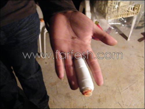 الرصاصة الطائشة واصابة جديدة في عرابة صورة رقم 9 الرصاصة الطائشة واصابة جديدة في عرابة صورة رقم 9