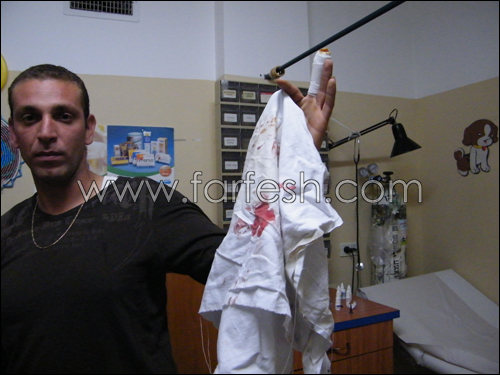 الرصاصة الطائشة واصابة جديدة في عرابة صورة رقم 3 الرصاصة الطائشة واصابة جديدة في عرابة صورة رقم 3