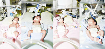 ولادة نادرة لأربعة توائم أصحاء من أم كويتية!!        صورة رقم 3