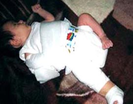 مولودة  فلسطينية عظامها من زجاج صورة رقم 1