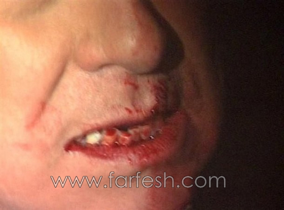 بيرلسكوني يتعرض لاعتداء جسدي في مدينة ميلانو     صورة رقم 8