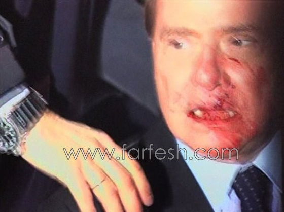 بيرلسكوني يتعرض لاعتداء جسدي في مدينة ميلانو     صورة رقم 1