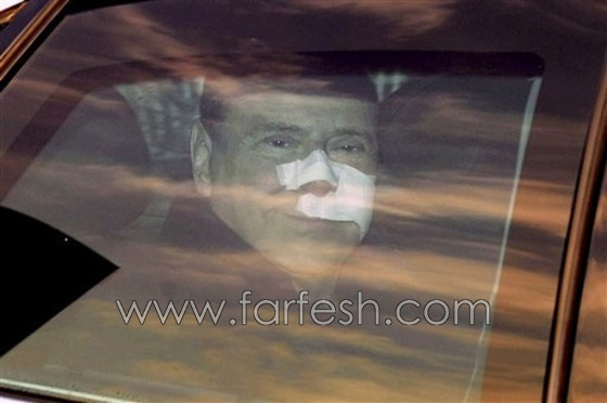 القضاء الايطالي يشك  أن الاعتداء على برلسكوني حيلة  مدبرة!!      صورة رقم 11