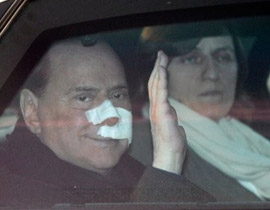 القضاء الايطالي يشك  أن الاعتداء على برلسكوني حيلة  مدبرة!!      صورة رقم 1