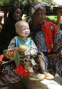 تنزانيا.. إعدام أفراد عصابة قتلوا أطفالا مهق وسرقوا أعضاءهم  صورة رقم 1