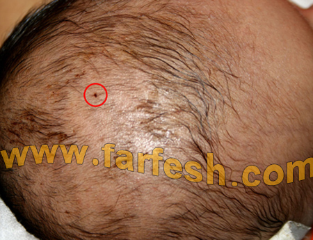 الغيرة دفعت فيتنامية لغرس إبرة في رأس ابن زوجها الرضيع  صورة رقم 4