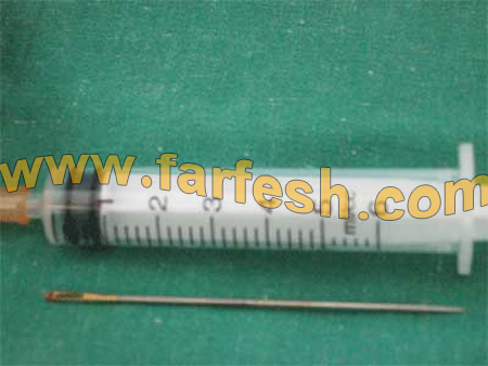 الغيرة دفعت فيتنامية لغرس إبرة في رأس ابن زوجها الرضيع  صورة رقم 7