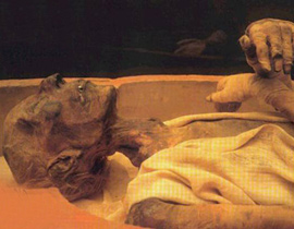 سرقة الأعضاء من جثامين الشهداء: المطالبة بلجنة تحقيق دولية صورة رقم 1