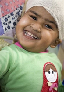 استيقاظ التوأم الثاني من عملية فصل ناجحة!!        صورة رقم 1