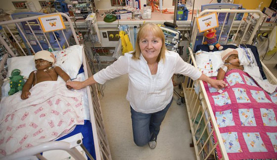 استيقاظ التوأم الثاني من عملية فصل ناجحة!!        صورة رقم 5