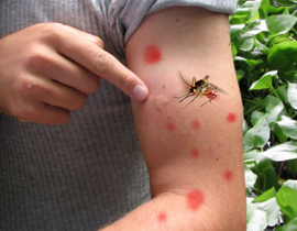 سيدة تطالب فندق بـ 5 ملايين ريال فقط بسبب لسع البعوض!! صورة رقم 1