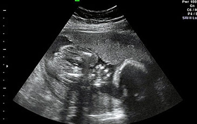 امرأة عاقر تناولت فياغرا مدة تسعة أيام وأصبحت حامل! صورة رقم 2