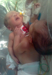 هل سينقذ الملك السعودي التوأم الفلسطيني ريتال وريتاج؟! صورة رقم 1