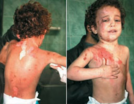 أم متوحشة: حرقت طفلتها وجلدتها لأنها حطمت علبة الماكياج! صورة رقم 1