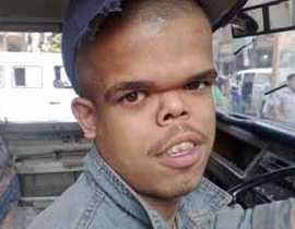 قزم مصري يروي معاناته وكيفية اختياره زوجة فارعة الطول صورة رقم 1 قزم مصري يروي معاناته وكيفية اختياره زوجة فارعة الطول صورة رقم 1