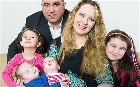 والدة التوأمين الملتصقين حسن وحسين: أتمنى حدوث معجزة  صورة رقم 3