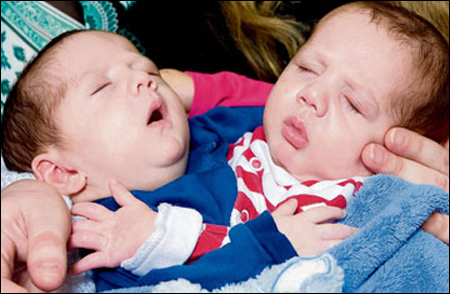 والدة التوأمين الملتصقين حسن وحسين: أتمنى حدوث معجزة  صورة رقم 1