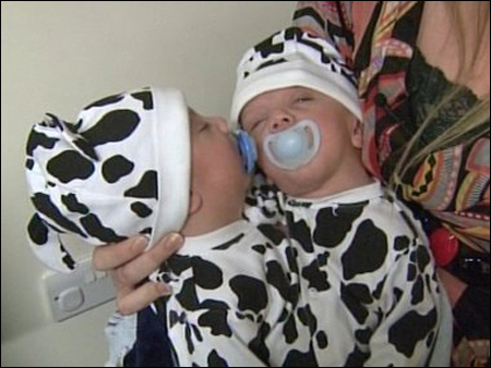 والدة التوأمين الملتصقين حسن وحسين: أتمنى حدوث معجزة  صورة رقم 4