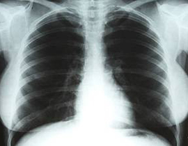 صدر ملكة الإغراء مارلين مونرو لا يساوي أكثر من 1200 دولار!  صورة رقم 1