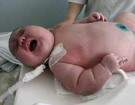 هل ستدخل مولودة مصرية بوزن 6 كغم ونصف كتاب غينيس؟ صورة رقم 1 هل ستدخل مولودة مصرية بوزن 6 كغم ونصف كتاب غينيس؟ صورة رقم 1