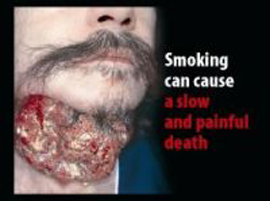 قريباً: صور مخيفة على علب السجائر!  صورة رقم 1