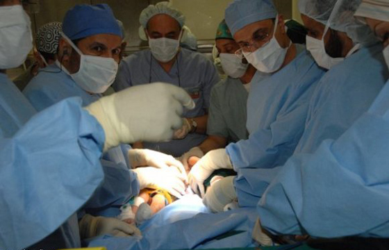 نجاح عملية فصل التوأم السيامي الاردني محمد وامجد  صورة رقم 6
