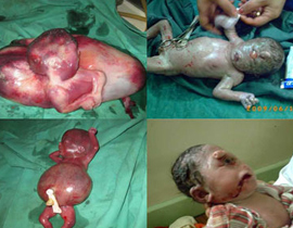 الأطباء يطالبون أمهات الفلوجة بعدم الإنجاب! صورة رقم 1