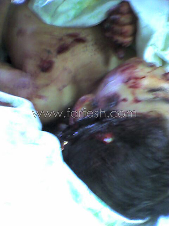 للكبار فقط: صور بشعة لضحايا جريمة كترمايا اللبنانية! صورة رقم 5 للكبار فقط: صور بشعة لضحايا جريمة كترمايا اللبنانية! صورة رقم 5