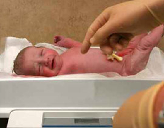 ولادة امرأة حامل بسبب تعرضها لحادث طرق!! صورة رقم 1