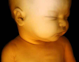 أحداث سبتمبر رفعت نسبة وفاة الاجنة الذكور! صورة رقم 1