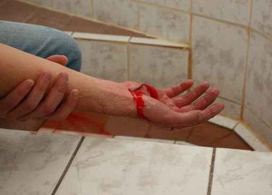 مصر: بتر ذراع صديقه بسبب 20 جنيه كان قد اقترضها منه!! صورة رقم 1