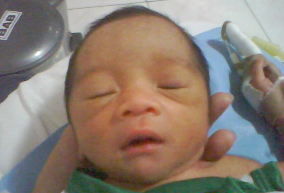 القابلة قطعت اصبع المولودة بدل الحبل السري!! صورة رقم 1 القابلة قطعت اصبع المولودة بدل الحبل السري!! صورة رقم 1