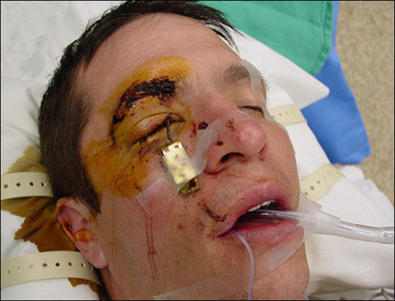 اراد التحكم بصنارة الصيد.. فاصطادته السمكة! صورة رقم 3 اراد التحكم بصنارة الصيد.. فاصطادته السمكة! صورة رقم 3