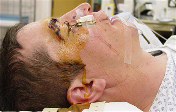 اراد التحكم بصنارة الصيد.. فاصطادته السمكة! صورة رقم 1 اراد التحكم بصنارة الصيد.. فاصطادته السمكة! صورة رقم 1