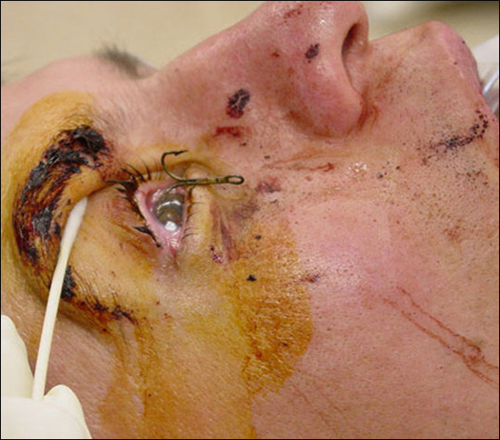 اراد التحكم بصنارة الصيد.. فاصطادته السمكة! صورة رقم 2 اراد التحكم بصنارة الصيد.. فاصطادته السمكة! صورة رقم 2