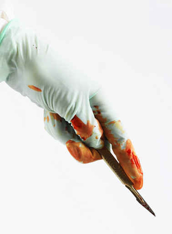 تشاجر مع زوجته فقطع عضوه الذكري بسكين! صورة رقم 1 تشاجر مع زوجته فقطع عضوه الذكري بسكين! صورة رقم 1