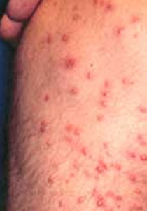  نمل النار: يهدد الولايات المتحدة لشدة إيذاءه وارتفاع تكلفة مكافحته صورة رقم 1