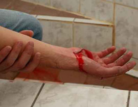 اختلف مع جارته.. فقطع ذراعها ببلطة!! صورة رقم 1