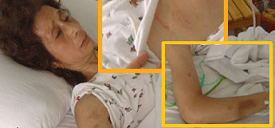 الشرطة تضرب زوجة مسؤول.. ظنوا بأنها مواطنة عادية!!        صورة رقم 2