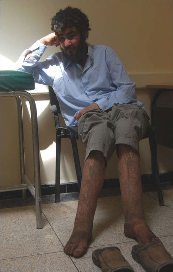 بعد اصابته بإكتئاب.. احتجزته امه في حجرة للبهائم لـ6 سنوات!  صورة رقم 3