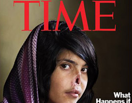 صورة عائشة المقطوع أنفها على غلاف التايم تثير الجدل صورة رقم 1