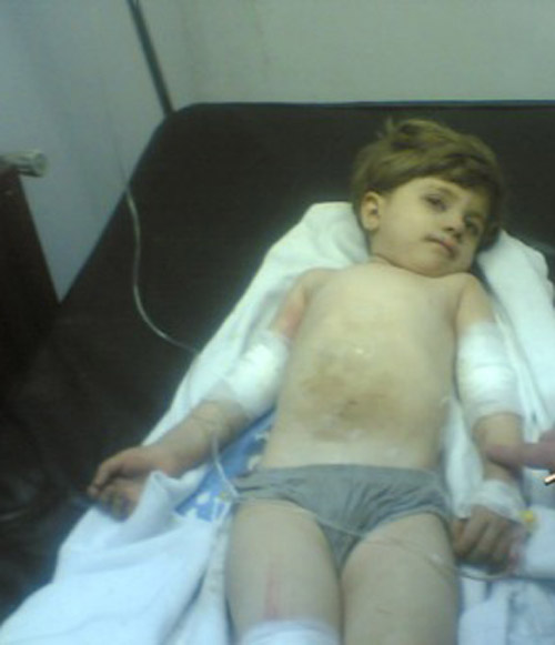 طفلة قضت 7 ساعات في بئر عمقها 20 متراً وقطرها 27 سم!!        صورة رقم 10