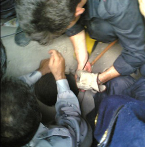 طفلة قضت 7 ساعات في بئر عمقها 20 متراً وقطرها 27 سم!!        صورة رقم 9