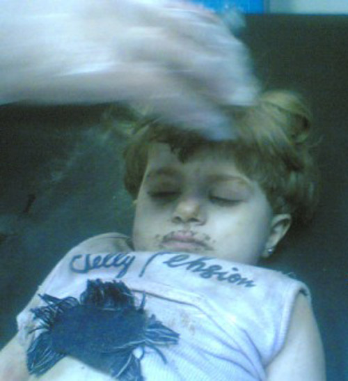 طفلة قضت 7 ساعات في بئر عمقها 20 متراً وقطرها 27 سم!!        صورة رقم 5