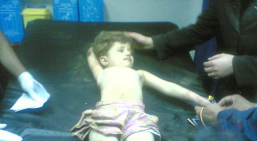 طفلة قضت 7 ساعات في بئر عمقها 20 متراً وقطرها 27 سم!!        صورة رقم 6